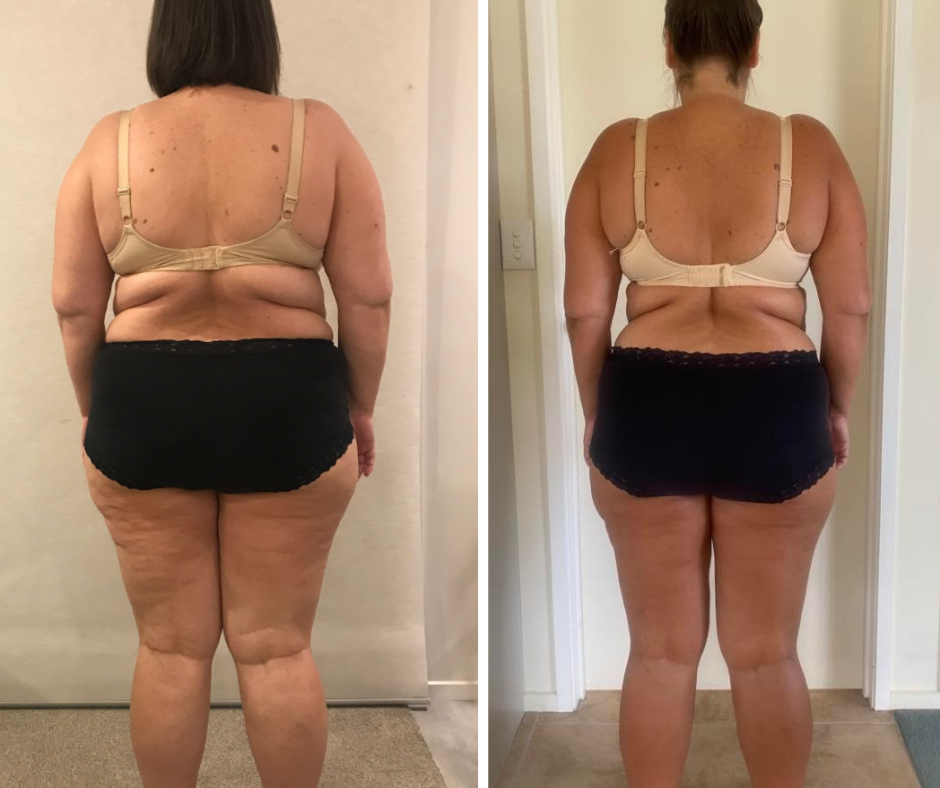 Nicole before and after, 13 kg lost