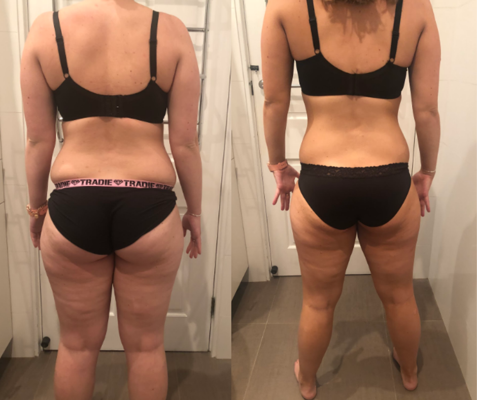 Maria before and after, 13 kg lost